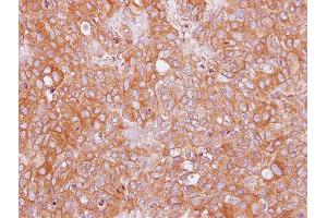 IHC-P Image Immunohistochemical analysis of paraffin-embedded BT474 xenograft, using AHCYL2, antibody at 1:100 dilution.