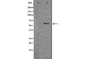 Western blot analysis of extracts from 293 cells, using ARX antibody.