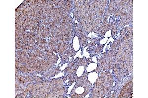 IHC analysis of PDIA6 using anti-PDIA6 antibody (ABIN7600553). (PDIA6 Antikörper  (AA 20-440))