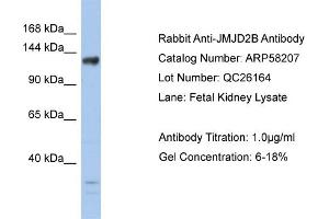 WB Suggested Anti-JMJD2B  Antibody Titration: 0. (KDM4B Antikörper  (Middle Region))