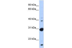 Western Blotting (WB) image for anti-Nuclear Receptor Subfamily 0, Group B, Member 2 (NR0B2) (Middle Region) antibody (ABIN2774985)