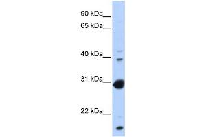 WB Suggested Anti-NR0B2 Antibody Titration:  0. (NR0B2 Antikörper  (Middle Region))