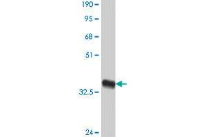 Western Blot detection against Immunogen (38. (KLRC3 Antikörper  (AA 132-240))