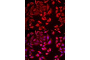 Immunofluorescence analysis of HeLa cells using CCT2 antibody. (CCT2 Antikörper  (AA 206-535))