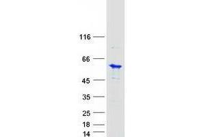 Western Blotting (WB) image for Ubiquitin-Conjugating Enzyme E2Q Family Member 1 (UBE2Q1) protein (Myc-DYKDDDDK Tag) (ABIN2734862)