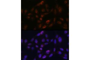 Immunofluorescence analysis of U2OS using SMC3 antibody (ABIN7270616) at dilution of 1:100.