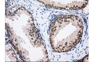 Immunohistochemical staining of paraffin-embedded Human Kidney tissue using anti-MTRF1L mouse monoclonal antibody. (MTRF1L Antikörper)