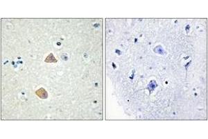 Immunohistochemistry analysis of paraffin-embedded human brain tissue, using EFNA5 Antibody. (Ephrin A5 Antikörper  (AA 31-80))