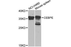 Western blot analysis of extracts of various cell lines, using CEBPE antibody. (CEBPE Antikörper  (AA 1-190))