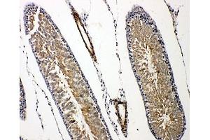 Immunohistochemistry (IHC) image for anti-Prolactin Receptor (PRLR) (C-Term) antibody (ABIN3032320)