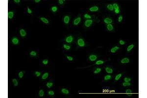 Image no. 2 for anti-TATA Box Binding Protein Associated Factor 11 (TAF11) (AA 158-211) antibody (ABIN598957) (TAF11 Antikörper  (AA 158-211))