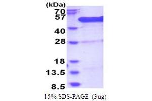 SDS-PAGE (SDS) image for BRCA2 and CDKN1A Interacting Protein (BCCIP) (AA 1-314) protein (His tag) (ABIN5853793)