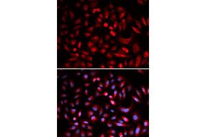 Immunofluorescence analysis of U2OS cells using PRKACB antibody (ABIN5973065). (PRKACB Antikörper)