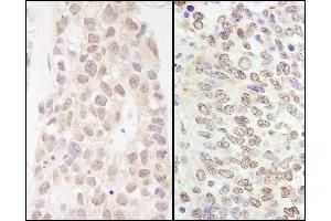 Immunohistochemistry (IHC) image for anti-GATA Zinc Finger Domain Containing 2B (GATAD2B) (AA 50-100) antibody (ABIN7453751)
