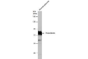 Western Blotting (WB) image for anti-Transferrin (TF) antibody (ABIN2854907)