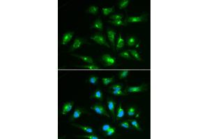 Immunofluorescence analysis of HepG2 cells using CD46 antibody (ABIN6293305). (CD46 Antikörper)