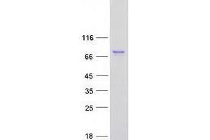 Western Blotting (WB) image for Tripartite Motif Containing 47 (TRIM47) protein (Myc-DYKDDDDK Tag) (ABIN2734275)