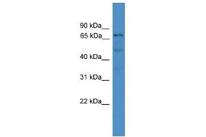 WB Suggested Anti-DDX51 Antibody Titration:  0. (DDX51 Antikörper  (Middle Region))
