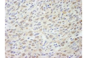 Immunohistochemistry (IHC) image for anti-Mediator Complex Subunit 18 (MED18) (C-Term) antibody (ABIN7448663)