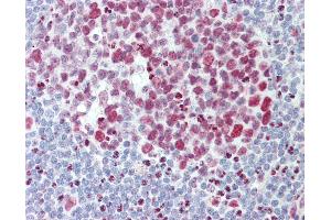 Anti-HNRNPAB antibody IHC staining of human tonsil. (HNRNPAB Antikörper  (AA 1-30))