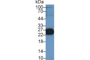 Western Blot; Sample: Mouse Skeletal muscle lysate; Primary Ab: 1µg/ml Rabbit Anti-Rat TNNI2 Antibody Second Ab: 0. (TNNI2 Antikörper  (AA 1-182))