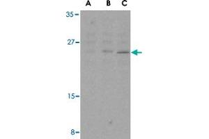 Western blot analysis of BCL2 in A-20 cell lysates with BCL2 polyclonal antibody  at (A) 1, (B) 2, and (C) 4 ug/mL . (Bcl-2 Antikörper  (Internal Region))