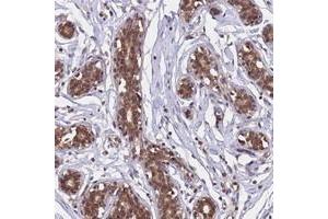 Immunohistochemical staining of human breast with C1orf35 polyclonal antibody  shows moderate cytoplasmic and nuclear positivity in glandular cell at 1:500-1:1000 dilution. (C1orf35 Antikörper)