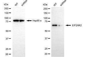 Western blotting analysis using EIF2AK2 antibody (ABIN7798506).