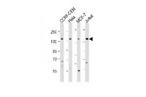 All lanes : Anti-PLCG1 Antibody (Center) at 1:2000 dilution Lane 1: CCRF-CEM whole cell lysates Lane 2: Hela whole cell lysates Lane 3: MCF-7 whole cell lysates Lane 4: Jurkat whole cell lysates Lysates/proteins at 20 μg per lane. (Phospholipase C gamma 1 Antikörper  (AA 456-488))
