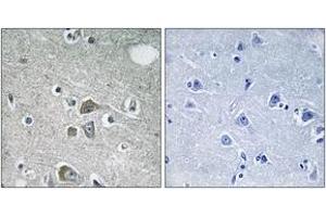 Immunohistochemistry (IHC) image for anti-Fibulin 2 (FBLN2) (AA 241-290) antibody (ABIN2890318)