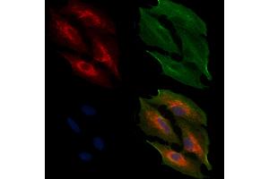 ABIN6257350 and ABIN6274727 staining  cells by IF/ICC.