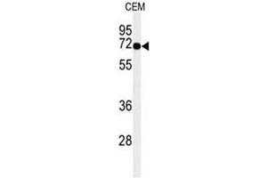 Western blot analysis of MFSD6 Antibody (C-term) in CEM cell line lysates (35µg/lane). (MFSD6 Antikörper  (C-Term))
