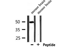 Western Blotting (WB) image for anti-Mucin 13, Cell Surface Associated (MUC13) (C-Term) antibody (ABIN6263429)