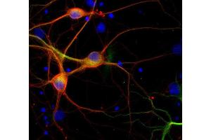 Immunofluorescence labeling of PFA fixed rat hippocampus neurons with β3-tubulin (dilution 1 : 500; red) and mouse anti-MAP 2 (, dilution 1 : 500; green).