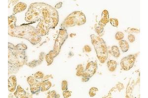 ABIN6260139 and ABIN6273198 at 1/100 staining human normal placenta tissue by IHC-P.