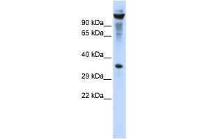 WB Suggested Anti-RNASET2 Antibody Titration:  0. (RNASET2 Antikörper  (Middle Region))