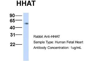 Host:  Rabbit  Target Name:  HHAT  Sample Type:  Human Fetal Heart  Antibody Dilution:  1.