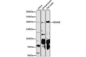 Western blot analysis of extracts of various cell lines, using KDM5B antibody (ABIN6293336) at 1:1000 dilution. (KDM5B Antikörper)