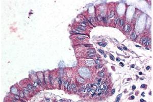 Human Colon (formalin-fixed, paraffin-embedded) stained with GPR116 antibody ABIN399995 at 10 ug/ml followed by biotinylated goat anti-rabbit IgG secondary antibody ABIN481713, alkaline phosphatase-streptavidin and chromogen. (G Protein-Coupled Receptor 116 Antikörper  (Internal Region))