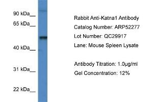 Western Blotting (WB) image for anti-Katanin P60 (ATPase Containing) Subunit A 1 (KATNA1) (C-Term) antibody (ABIN2784857) (KATNA1 Antikörper  (C-Term))