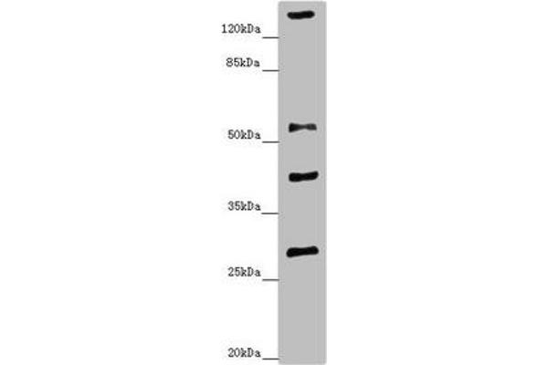 ZNF187 Antikörper  (AA 239-478)