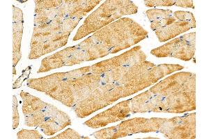 ABIN6258379 and ABIN6274790 at 1/100 staining Rat muscle tissue by IHC-P.