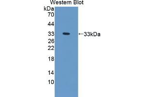 Western blot analysis of the recombinant protein. (TREH Antikörper  (AA 151-411))