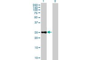 Western Blot analysis of CTRB1 expression in transfected 293T cell line by CTRB1 MaxPab polyclonal antibody. (CTRB1 Antikörper  (AA 1-263))