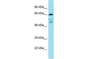 Western Blotting (WB) image for anti-Fidgetin-Like 2 (FIGNL2) (Middle Region) antibody (ABIN2791546)