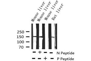 Western blot analysis of Phospho-EGFR (Tyr1197) expression in various lysates