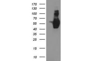 Western Blotting (WB) image for anti-Golgi Membrane Protein 1 (GOLM1) antibody (ABIN1498491)