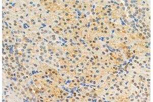 ABIN6262226 and ABIN6272920 at 1/100 staining Rat kidney tissue by IHC-P. (HEY1 Antikörper  (Internal Region))