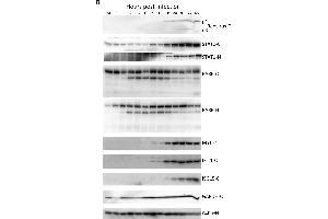 Western blot validation of host protein regulation. (ISG15 Antikörper)