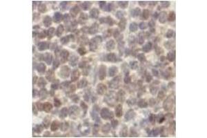 Immunohistochemistry (IHC) image for anti-Cyclin D1 (CCND1) antibody (ABIN1106871) (Cyclin D1 Antikörper)